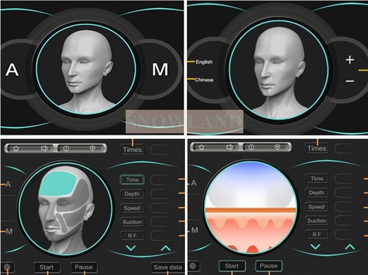 Semiconductor 808nm Diodo láser Máquina de depilación láser con sensor de contacto con la piel que garantiza un tratamiento rápido de depilación