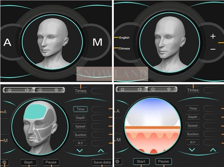 Semiconductor 808nm Diodo láser Máquina de depilación láser con sensor de contacto con la piel que garantiza un tratamiento rápido de depilación